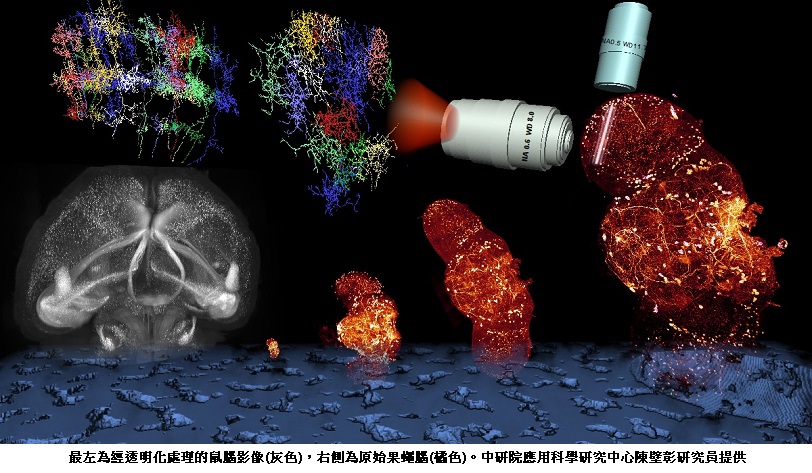 讓腦組織「放大」六萬四千倍!臺灣團隊突破光學極限,看見大腦突觸的奈米細節
